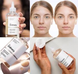 تونر گلایکولیک اسید 7%