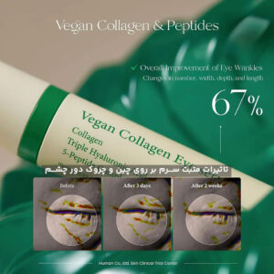 سرم دور چشم کلاژن اکسیس وای Axis-Y ضد چروک و روشن کننده