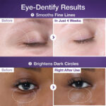 کرم دور چشم نامبوزین حاوی رتینول