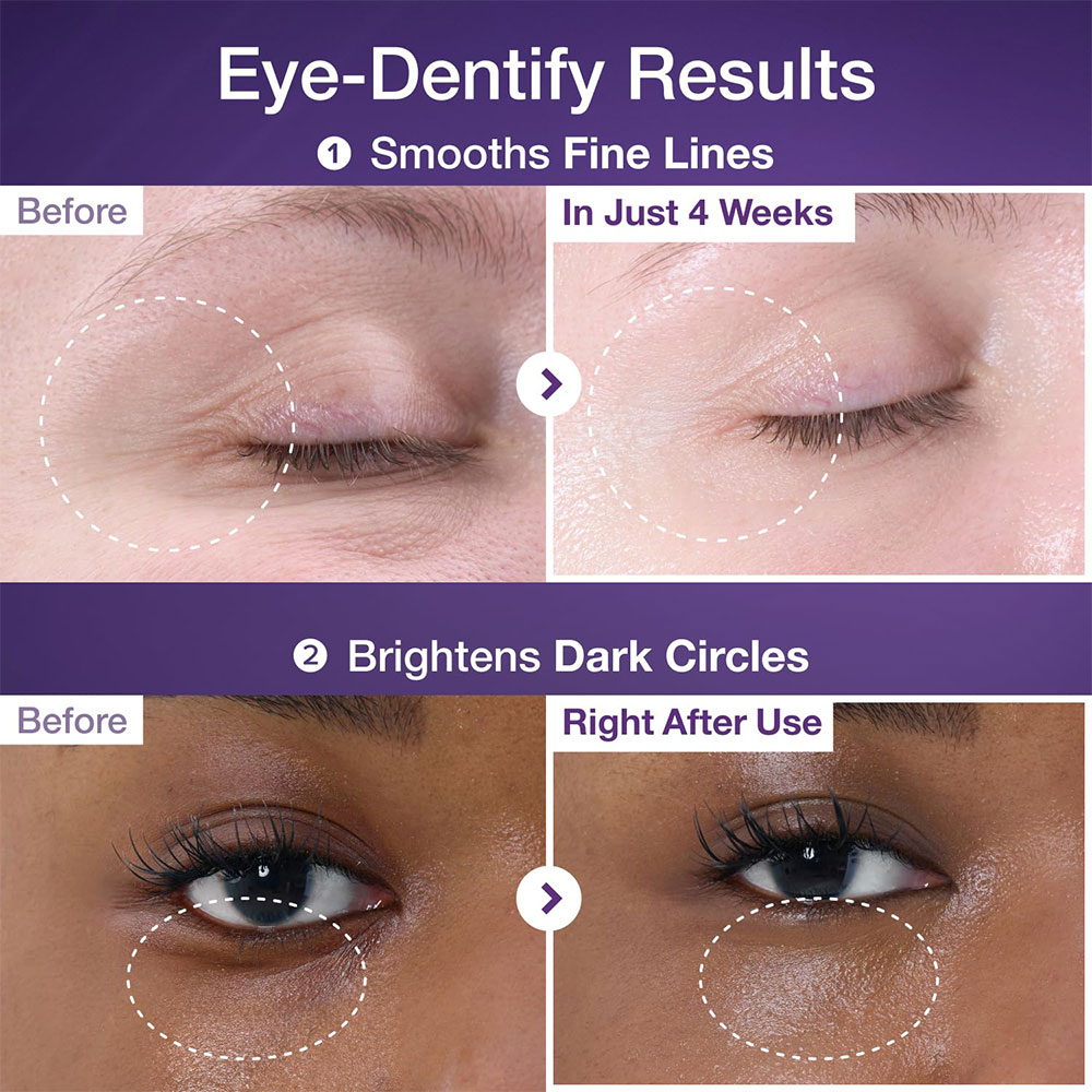 کرم دور چشم نامبوزین حاوی رتینول