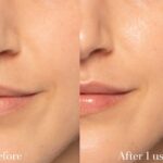 بوستر تقویت کننده ۶ پپتاید کوزارکس