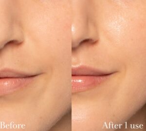 بوستر تقویت کننده ۶ پپتاید کوزارکس