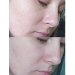 تونر پروپولیس کوزارکس