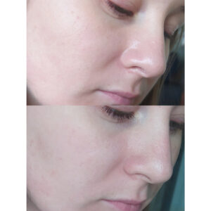 تونر پروپولیس کوزارکس