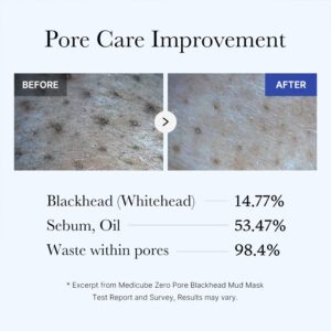 ماسک کوچک کننده منافذ و ضد جوش سرسیاه مدی کیوب