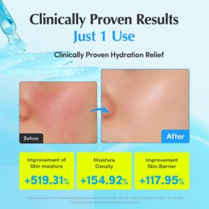سرم آبرسان هیالتوئین اکوال بری