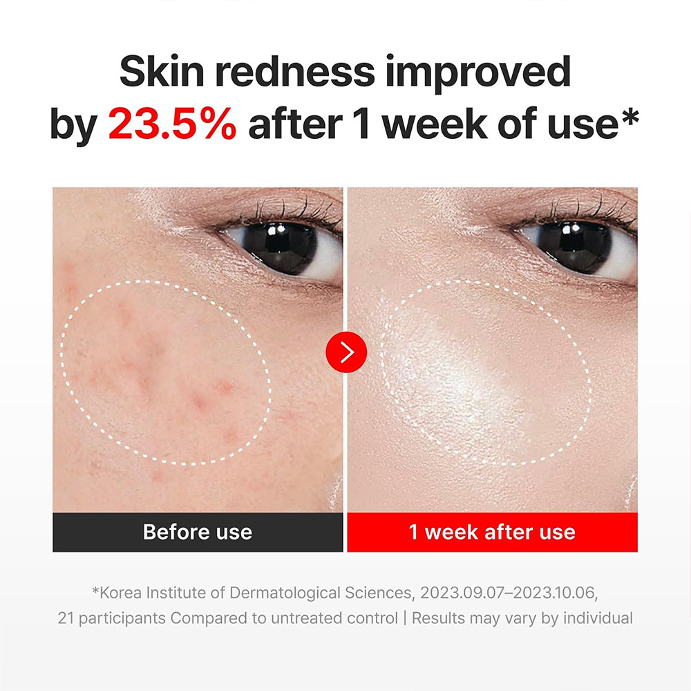 کرم ترمیمکننده و ضدپیری صورت سنتلیان
