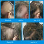 قرص نورکرین آقایان
