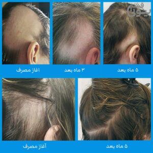 قرص نورکرین آقایان
