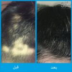 قرص نورکرین آقایان