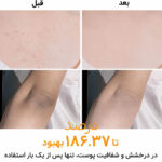 اسپری لایه بردار و روشن کننده دکتر ملاکسین
