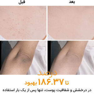  اسپری لایه بردار و روشن کننده دکتر ملاکسین