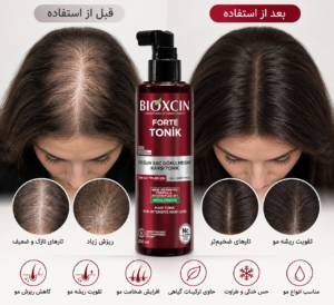 تونیک ضدریزش مو فورت بیوکسین